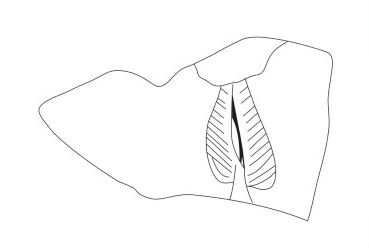 Byzantine Period Ceramic #1401 technical drawing