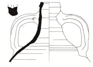 Roman Period Ceramic #1759 technical drawing