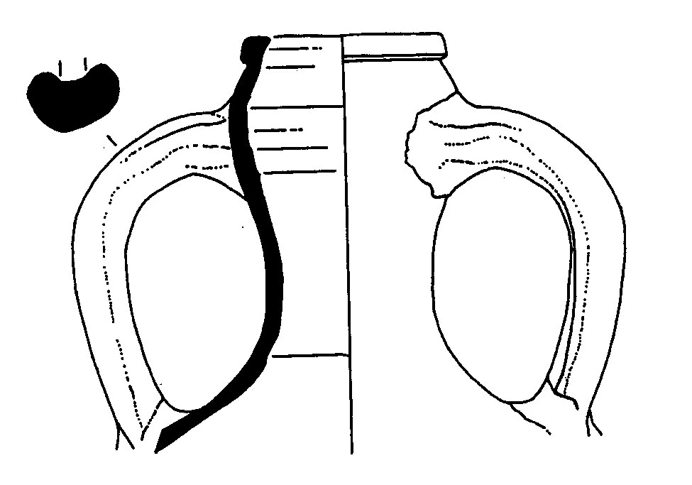Roman Period Ceramic #1928 technical drawing